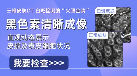 伍德灯检查白斑准确率高不高