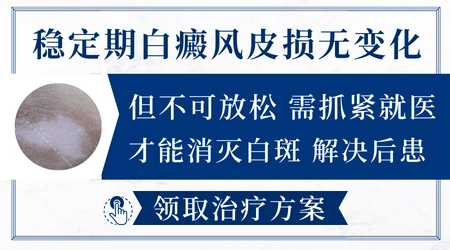 白斑好几年没变化是白癜风吗