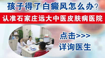 小孩白癜风初期症状图片