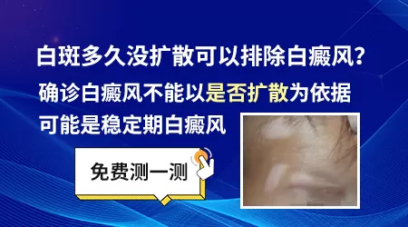白斑不扩散是白癜风吗
