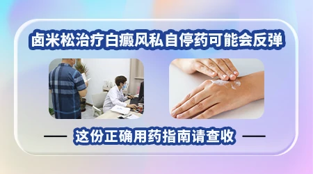 白癜风用卤米松会爆发吗