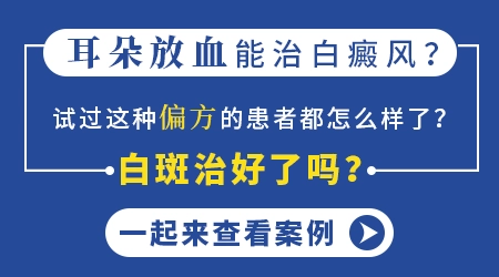 耳朵放血疗法治白癜风管用吗