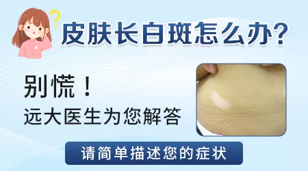 汗斑与白癜风怎么区分图片