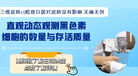 婴幼儿长白斑能做皮肤CT检测吗
