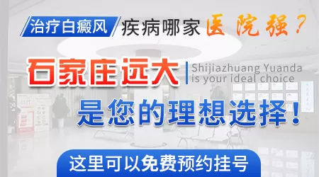 白斑移植手术后出现色差如何处理