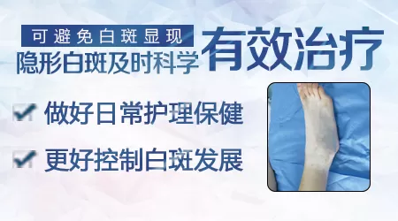 隐性白斑以后一定肯定会变成白癜风吗