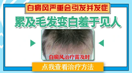 白块部位毛发变白是否严重