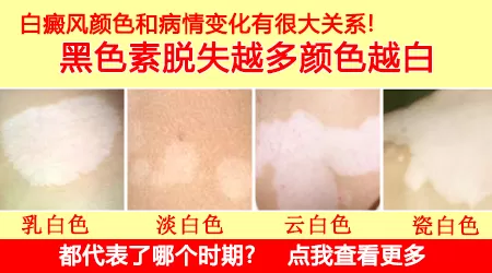 黑素细胞数量减少和完全缺失分别代表什么