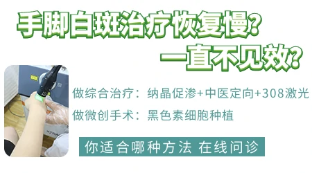 手脚上的白癜风为什么更难治
