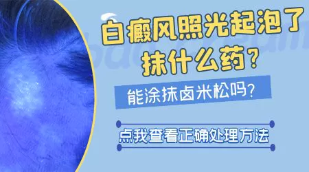 白癜风光疗起水泡之后多久恢复光疗