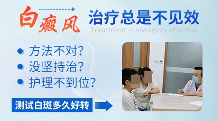 白癜风治疗很久一直不见效咋办