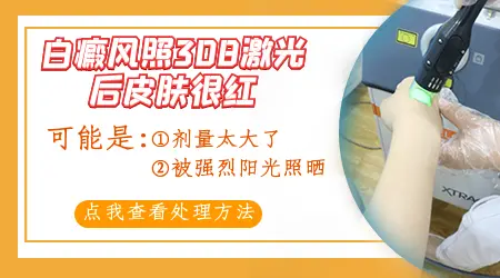 白癜风光疗后出现红肿怎么办
