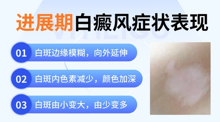 白斑数量增多是不是进展期