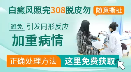 白癜风光疗后皮肤干燥脱皮怎么办