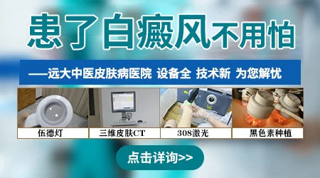 石家庄哪家医院看白癜风好