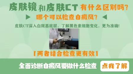 皮肤CT和皮肤镜有什么区别