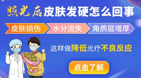 白癜风进展期如何控制扩散