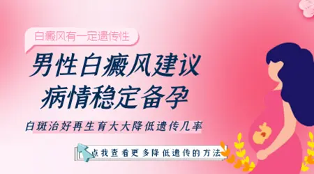 爸爸有白癜风会不会遗传给儿子