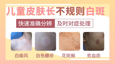 儿童嘴角有白色斑块怎么回事