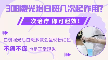 一小块白癜风308激光几次能好