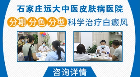 白癜风进展期和稳定期如何判断