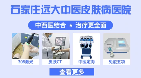 石家庄医院治疗白癜风排名