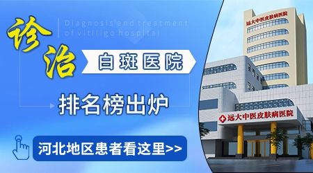 石家庄医院治疗白癜风排名