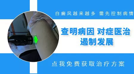怎么控制白癜风不扩散