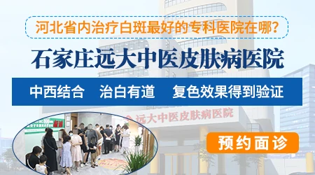 石家庄白癜风哪里看的好