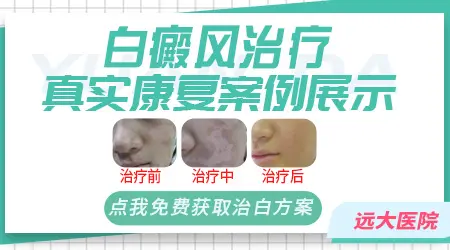 石家庄白癜风专科医院推荐哪家