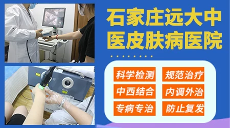 石家庄哪位医生治白癜风有名