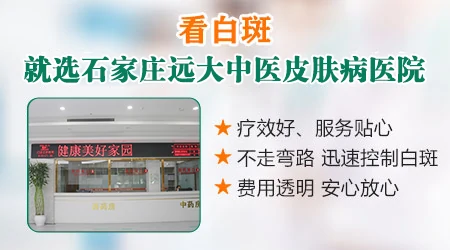 如何区分色素脱失斑与白癜风