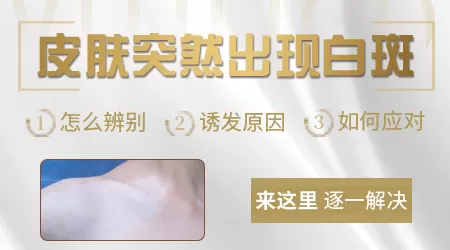 白癜风和其他白斑病症状有什么区别
