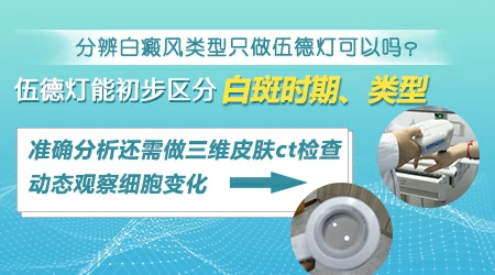 白癜风分型有哪些 如何判断类型