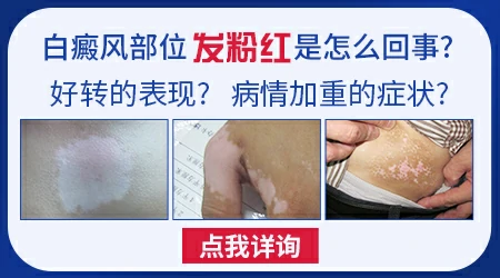 白斑周围变粉红色是什么情况