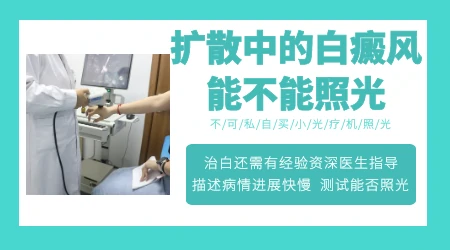发展期白癜风能做光疗吗 会不会越照越白