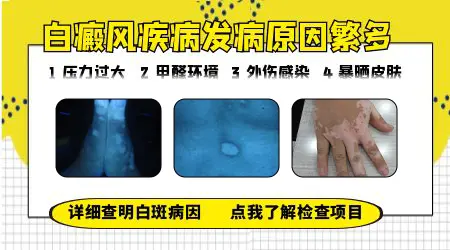 白癜风怎么引起的 常见的发病原因有哪些