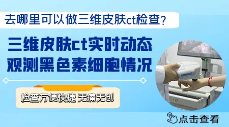 石家庄哪里可以做皮肤ct检测白斑