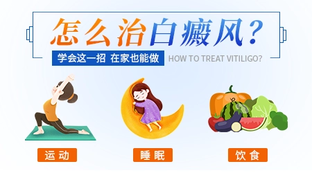 晕痣会发展成白癜风的概率有多少