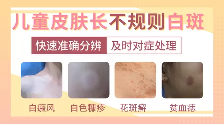 儿童嘴角有一小块皮肤变白色是什么情况
