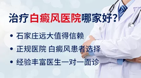 石家庄去哪里看白癜风效果好