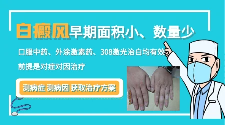 小面积白斑能不能只做遮盖不治疗