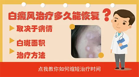 一般情况下白癜风治疗多久才能看到效果