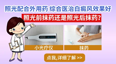 白癜风光疗前能不能抹药