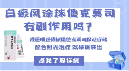 眼周和口周白癜风能直接涂他克莫司软膏吗