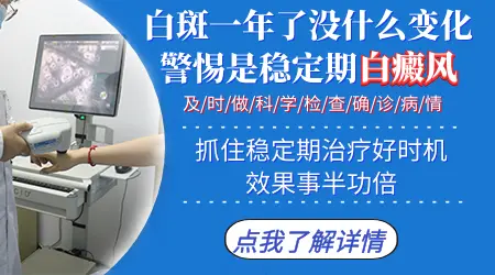身上有白斑几个月都没消会是白癜风吗