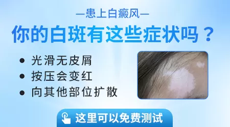 白癜风和其他普通白斑有什么区别