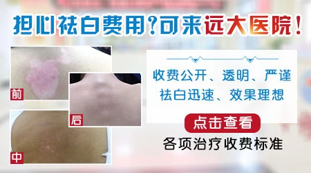 石家庄哪家医院专门治白癜风