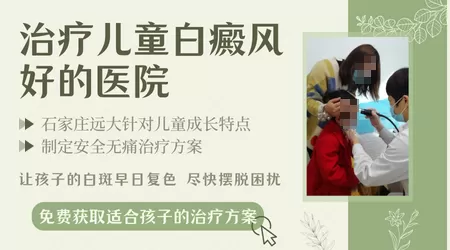 儿童白癜风去石家庄哪家医院治疗效果好