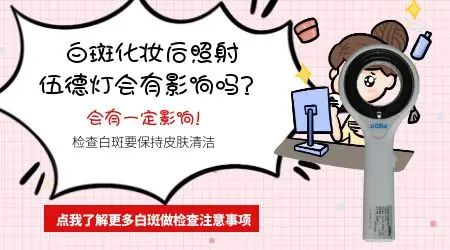 白斑检查前擦了药膏会影响伍德灯结果吗